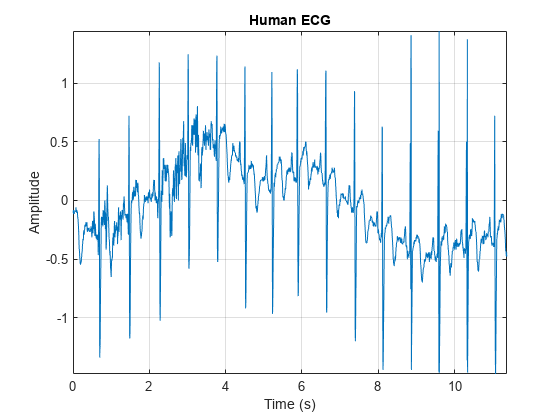 图中包含一个axes对象。标题为Human ECG的axis对象包含一个类型为line的对象。