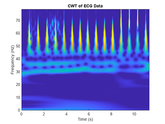 图中包含一个axes对象。标题为CWT的ECG数据轴对象包含一个类型为图像的对象。