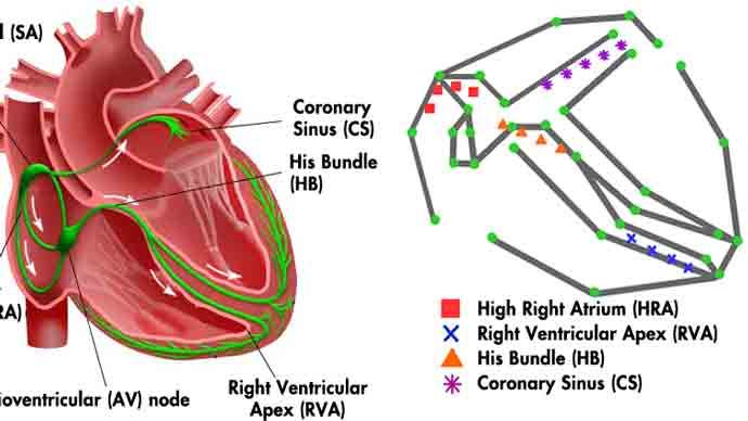 宾夕法尼亚大学发展心脏起搏器的心脏电生理模型实时闭环测试