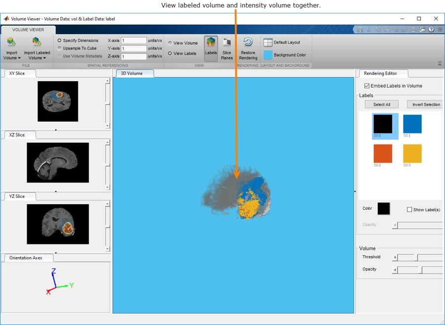 Volume Viewer应用程序可以让您与3D体积或标记的3D体积数据进行交互和查看。