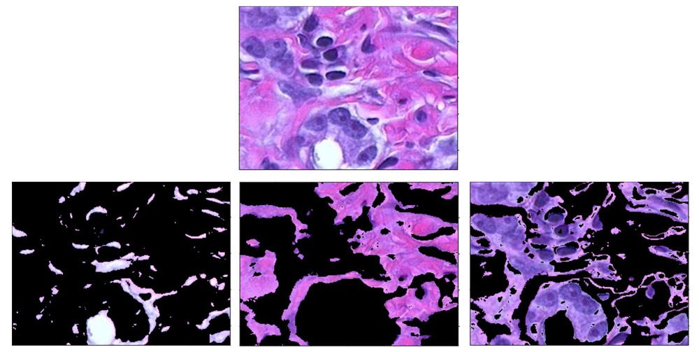 利用聚类方法在苏木精和伊红染色的人体组织图像中区分组织类型。