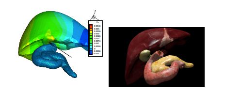 图5。使用PGD计算的肝脏表面3D效果图。