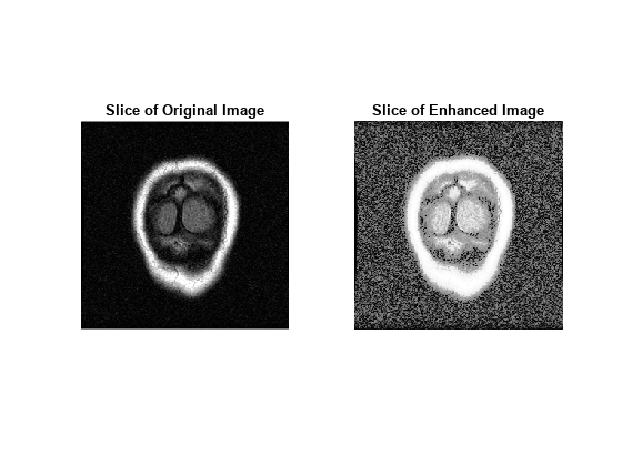 图中包含2个轴对象。标题为Slice of Original Image的Axes对象1包含一个Image类型的对象。标题为Slice of Enhanced Image的Axes对象2包含一个Image类型的对象。