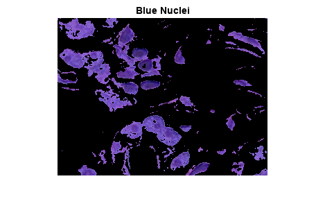 图中包含一个axes对象。标题为Blue原子核的axis对象包含一个类型为image的对象。