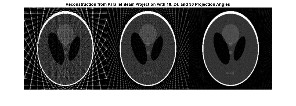 图中包含一个axes对象。标题为“从具有18、24和90个投影角度的平行光束投影重建”的axis对象包含一个类型为image的对象。