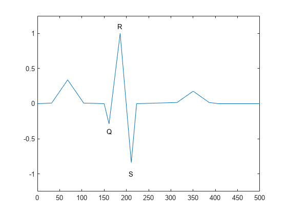 图中包含一个axes对象。axis对象包含4个类型为line、text的对象。gydF4y2Ba
