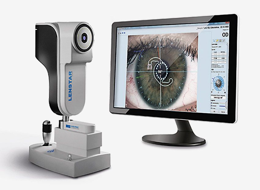 左边是Lenstar 900生物计;右边是一台计算机显示器，上面有一个眼睛的特写，正在测量术前和术后的特征。