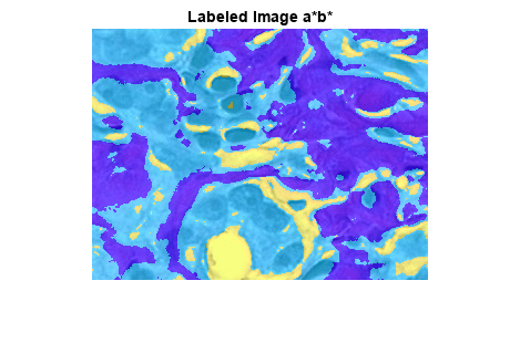 图包含一个轴对象。标题为Image a*b*的axes对象包含一个Image类型的对象。