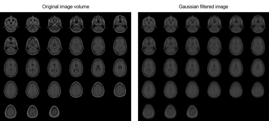 En este ejemplo se muestra cómo suavizar imágenes de共振magnética de un cerebro humano mediante el filtrado gaussiano 3D。