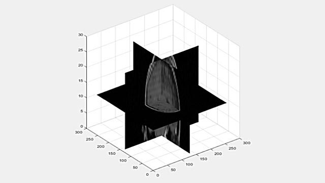 Visualización de un volumen 3D como secciones 2D。