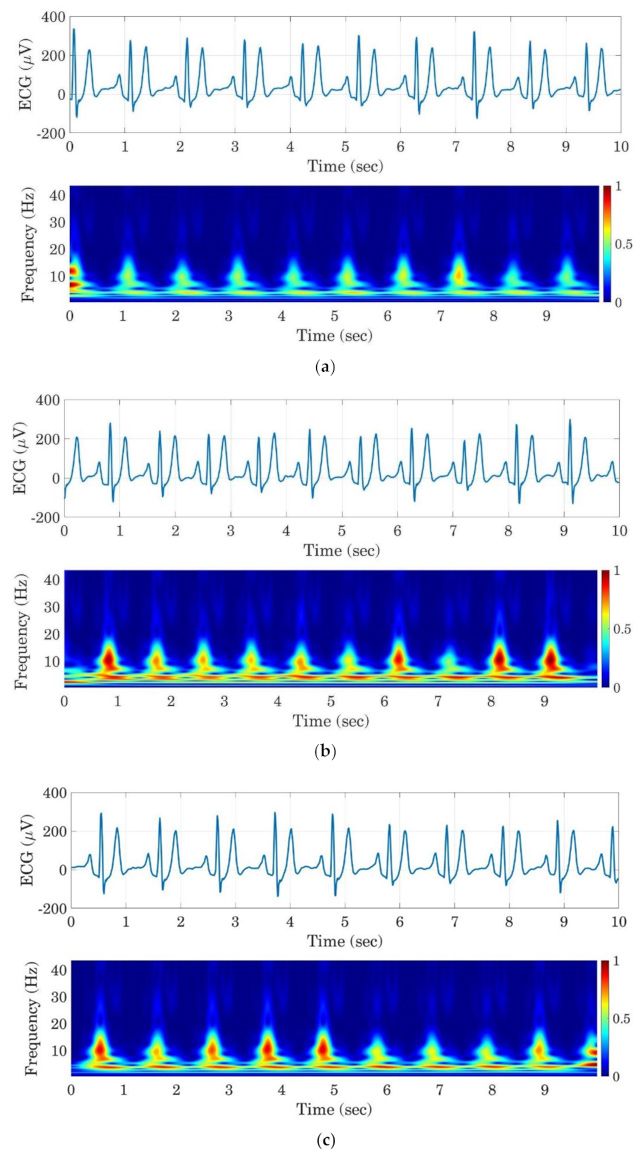 三张图显示了当受试者变得昏昏欲睡时，心电图信号频率是如何增加的。警觉的司机的频率为0.5 hz或更低，而极度困倦的司机达到1hz。