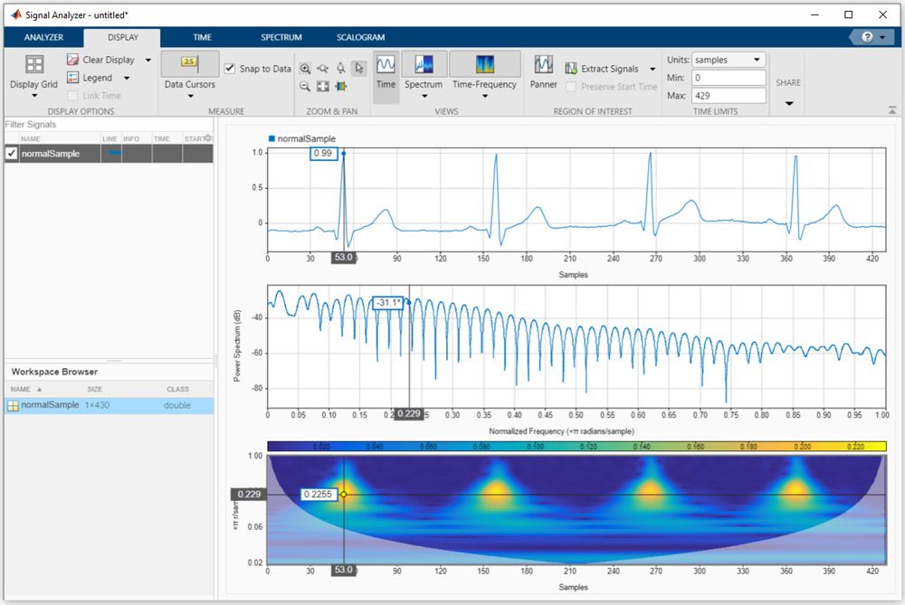 使用MATLAB中的signal Analyzer应用程序在时间，频率和时频域分析心电信号。